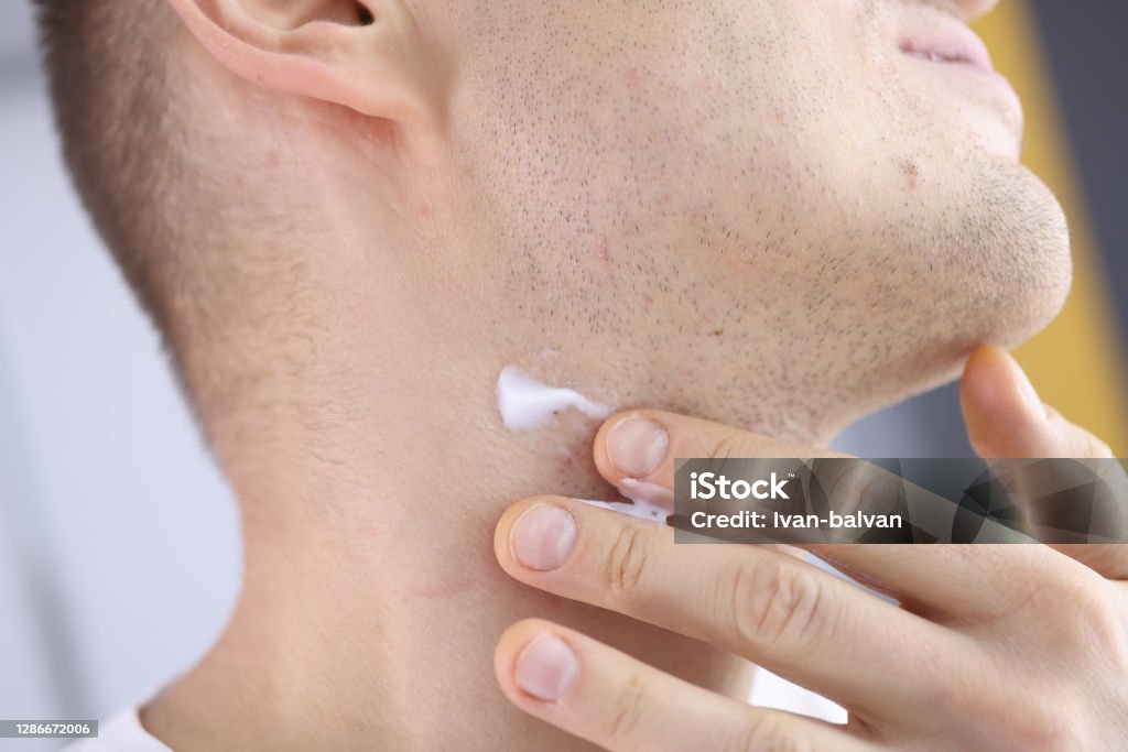 Man applying shaving cream with razor bumps on neck